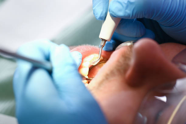 Best Emergency Root Canal Treatment in Levittown, PA